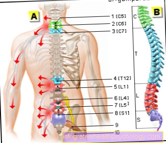 Obrázek herniated disk - příznaky