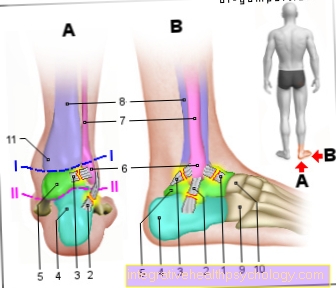 Slika raztrgan ligament