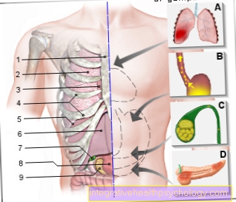 Hình đau ngực phải