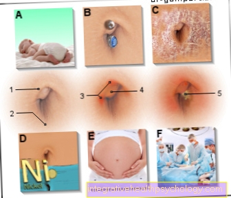 Illustration inflammation navel