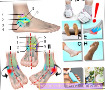 Sosok kaki bersudut