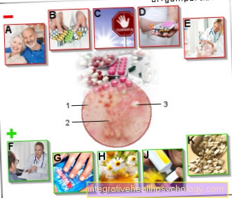 Illustrationudslæt efter at have taget antibiotika