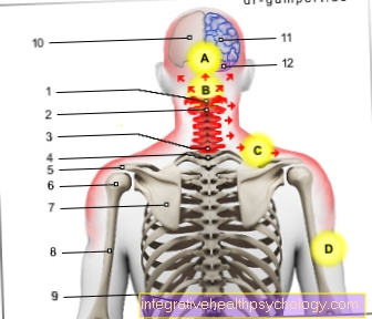 Gambar sindrom tulang belakang serviks