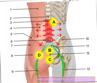 Figura síndrome de la columna lumbar