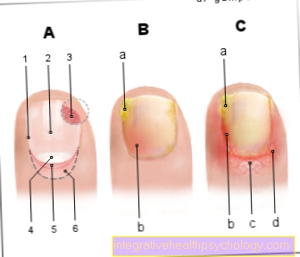 Figur inflammation i nagelbädden