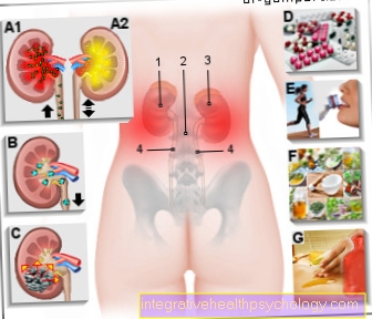 Illustration kidney pain