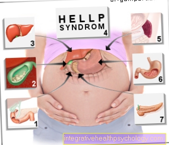 Figure epigastric pain during pregnancy
