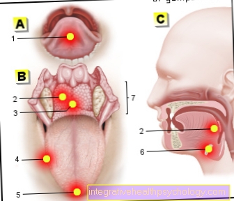 Figure pain on the tongue