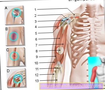 Figure pain in the upper arm