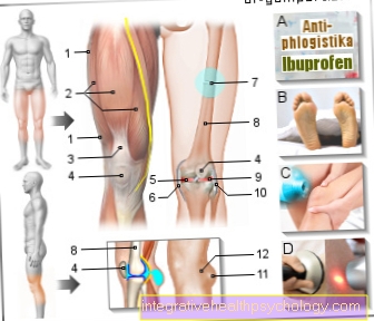 Figure pain above the knee