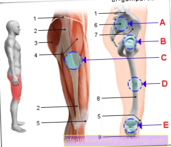 Figur Smärta yttre lår