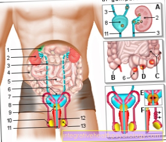 Figura dolor abdominal - hombre