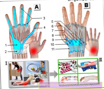 Figure tendinitis on the wrist