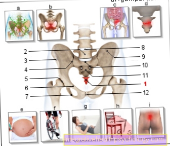 Figurați durerea la nivelul coloanei vertebrale