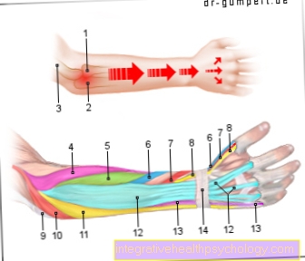 Figure tennis elbow