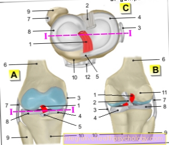 Gambar ligamentum cruciatum anterior