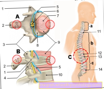 Figura fractura vertebral