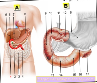 Gambar duodenum