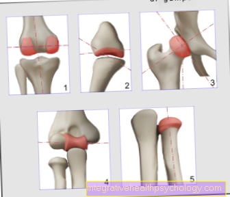 Illustrations of joint shapes