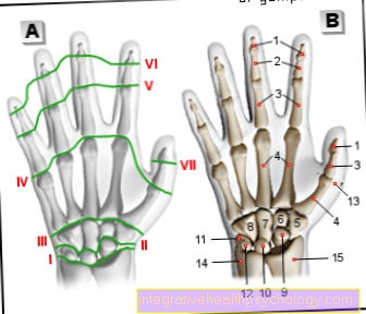 Scaphoid