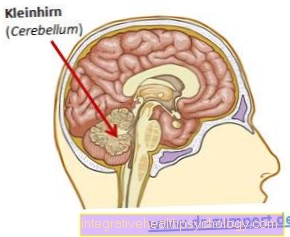 ซีรีเบลลัม