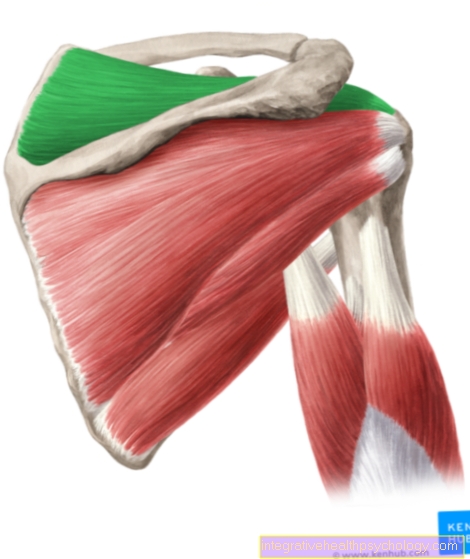 Músculo supraespinoso