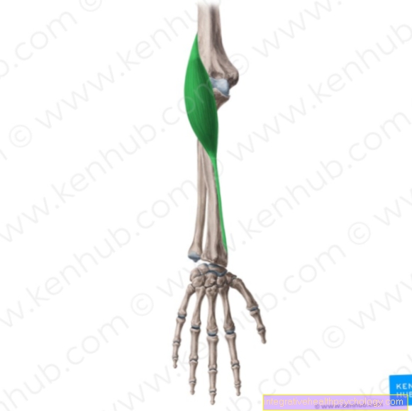 Otot radial lengan atas