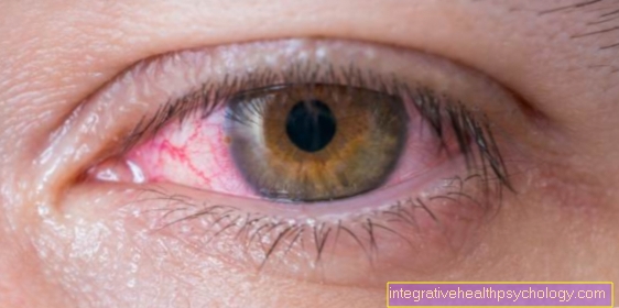 Broken vein in the eye