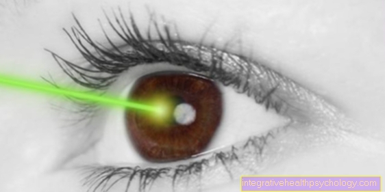 Laser therapy for astigmatism