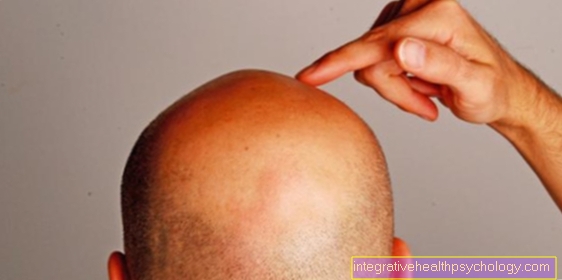 Abscess on the head