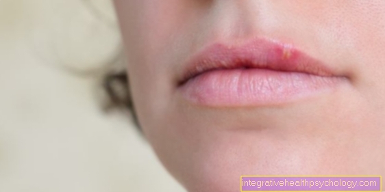 Duración del herpes labial