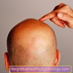 The therapy for hair loss