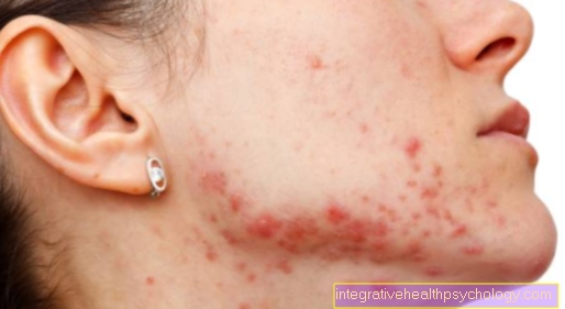 Rash with pustules