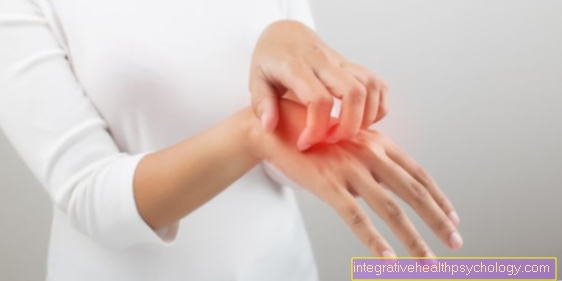 Dermatita atopică a mâinii