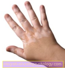 Skin pigmentation disorder