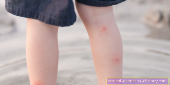 Red spots on the legs - warning sign or harmless?