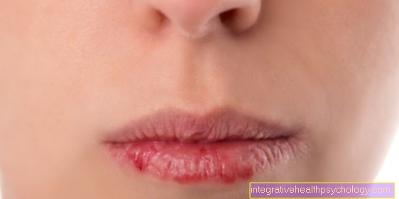 Dry lips