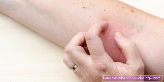 Causes of atopic dermatitis