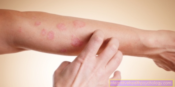 How contagious is scabies?