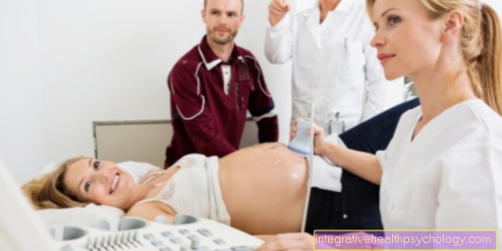 Doppler sonography