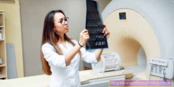MRI ręki