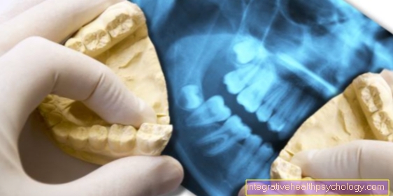 X-ray of teeth