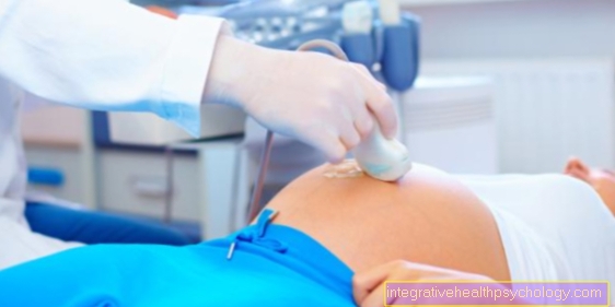 Ultralydundersøgelse under graviditet