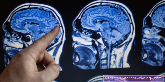 Pemeriksaan tengkorak dan otak menggunakan MRI