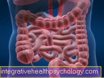 Nutritional therapy for chronic inflammatory colon disease