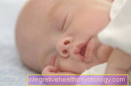 Induction of childbirth