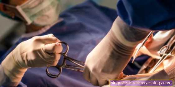 Hysterectomy - the removal of the uterus