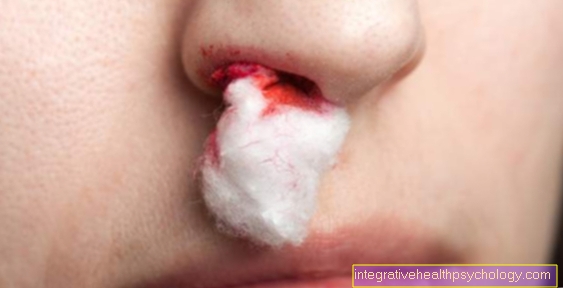 Epistaxis during stress