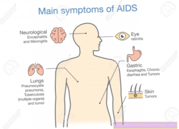 AIDS symptomer