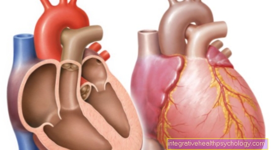 Aortic stenosis